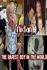 Watch Aidan The Rarest Boy In The World Alluc