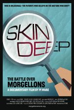 Watch Skin Deep: The Battle Over Morgellons Alluc