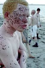 Watch Albino United Alluc