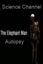 Watch Science Channel Elephant Man Autopsy Alluc