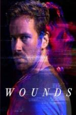 Watch Wounds Alluc