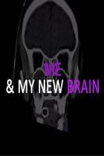 Watch Me & My New Brain Alluc