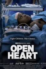Watch Open Heart Alluc