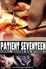 Watch Patient Seventeen Alluc