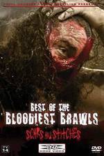 Watch TNA Wrestling: Best of the Bloodiest Brawls - Scars and Stitches Alluc