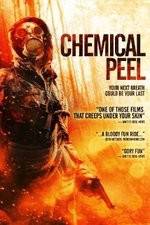 Watch Chemical Peel Alluc