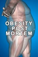 Watch Obesity: The Post Mortem Alluc