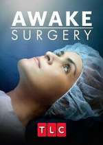 Watch Awake Surgery Alluc
