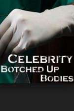 Watch Celebrity Botched Up Bodies Alluc